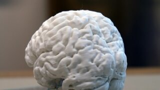 Türkiye’de İlk Kez Yaşayan Bir İnsan Beyninin 3D Kopyası Yapıldı