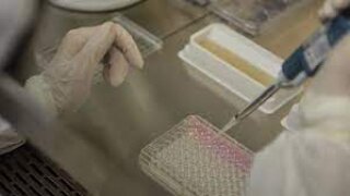 Kan Testinde; Demir Bağlama Kapasitesi Nedir? Eksikliği veya Yüksekliği?